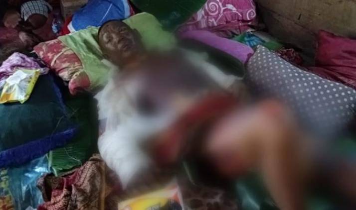 CuplikCom-Setengah-Bulan-Dirawat-Intensif-Nasrudin-Korban-Luka-bakar-Akhirnya-Meninggal-Dunia-30012022135446-IMG-20220130-WA0020.jpg